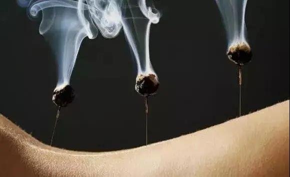 艾灸不是藥，調的不是病，央視為艾灸正名，讓我們正視艾灸