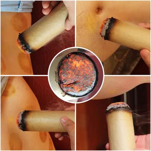 灸溫，到底是燙的好還是溫的好？為什么有的人感覺不到熱?