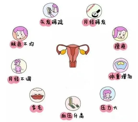 10個女人就有1個患多囊！被它纏上不要怕，艾灸幫你調“多囊”！